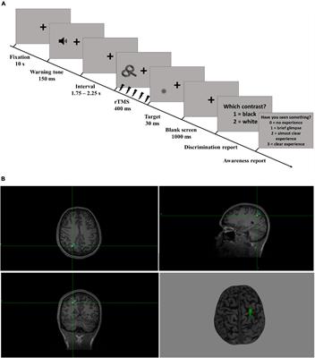 Effects of Rhythmic Transcranial Magnetic Stimulation in the Alpha-Band on Visual Perception Depend on Deviation From Alpha-Peak Frequency: Faster Relative Transcranial Magnetic Stimulation Alpha-Pace Improves Performance